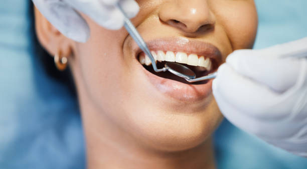 Best Dentist for Tooth Abscess  in Flossmoor, IL