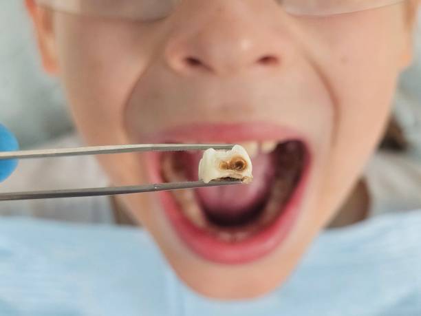 Best Dentist for Severe Toothache  in Flossmoor, IL
